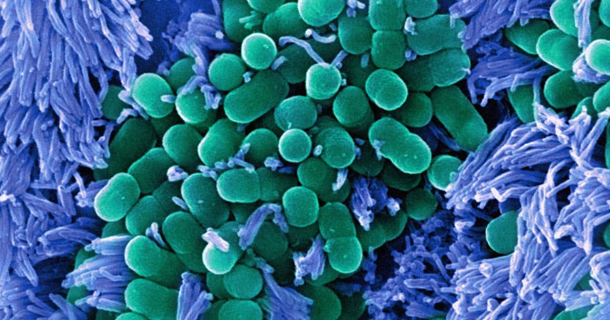 bakterie jelitowe na odchudzanie